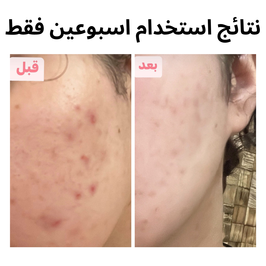 فلتر العناية بالبشرة